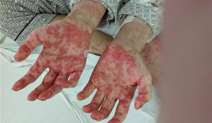 室內(nèi)甲醛檢測治理，你不得不需要了解的三點！